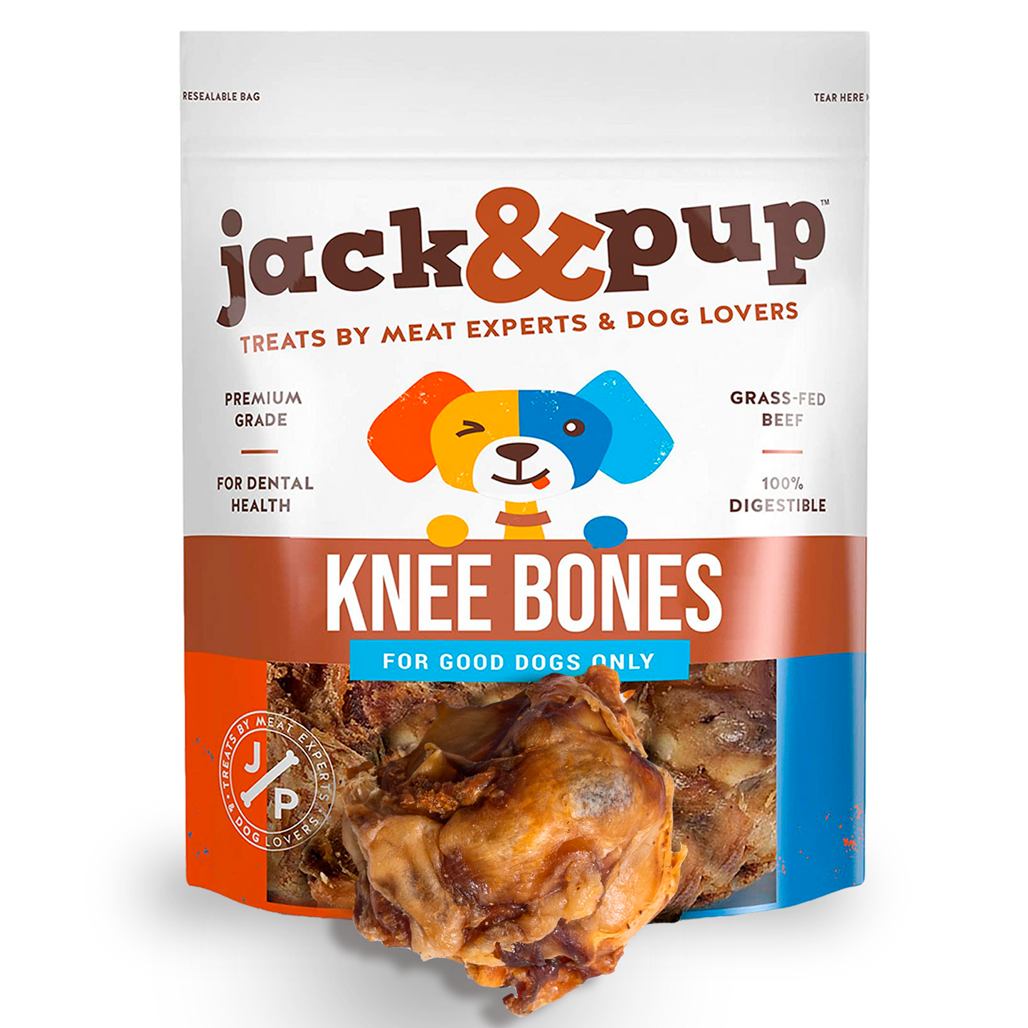 Knee Bones